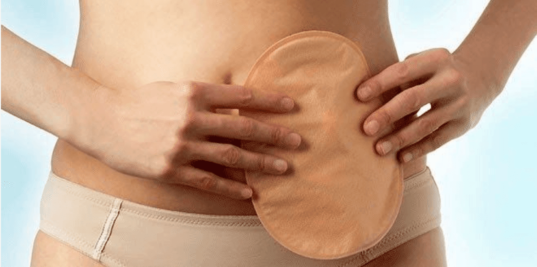 Campanha combate preconceito contra os ostomizados da SBCP, com a Dra Ana Sarah