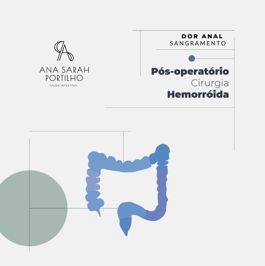 Pós-operatório de cirurgia de hemorroida