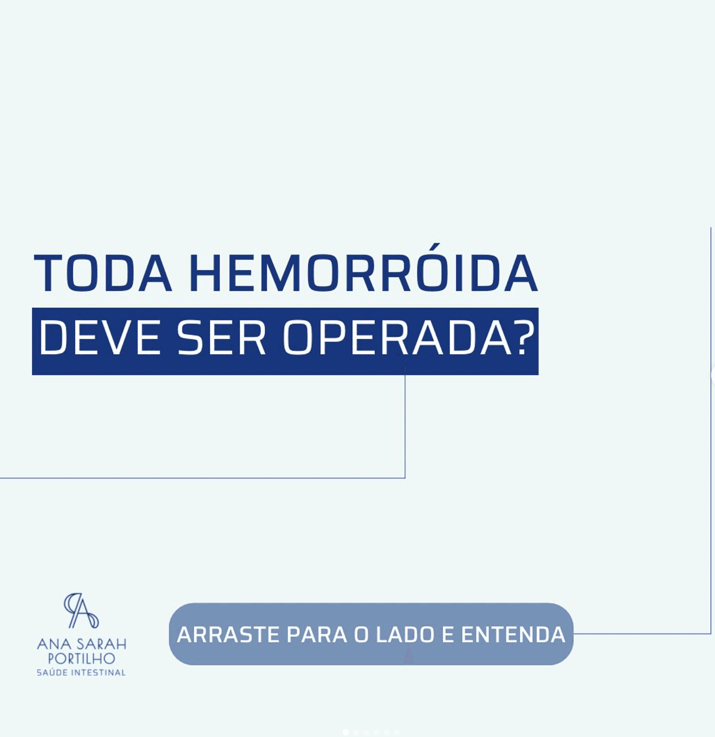 Toda hemorroida deve ser operada?